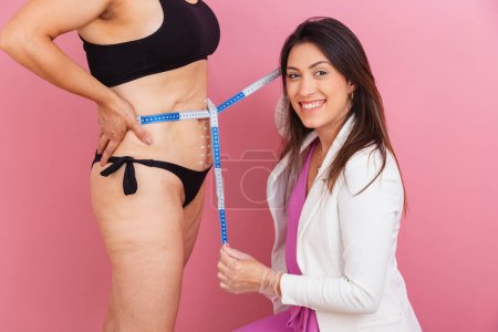 Photo for Beautician holding tape measure on patient's belly, risks for performing aesthetic procedures. - Royalty Free Image