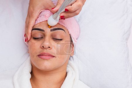 Application of facial radiofrequency for the treatment of melasma in a patient. skin care
