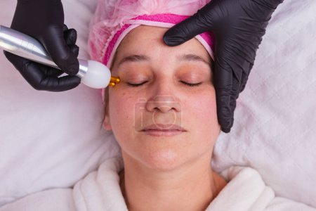 Foto de Hermosa mujer adulta. haciendo tratamiento facial con chorro de plasma en clínica de belleza. - Imagen libre de derechos