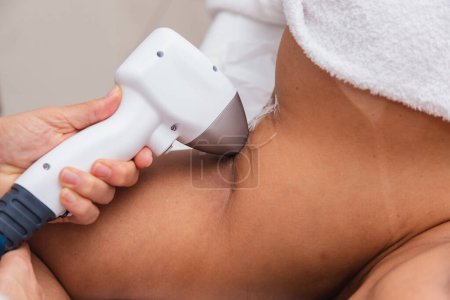 Photo for Aesthetic clinic, photo of laser hair removal procedure. - Royalty Free Image