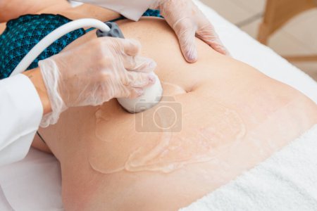 Photo for Aesthetic clinic, photo of ultrasound procedure, radiofrequency, slimming. - Royalty Free Image