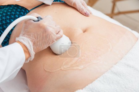 Photo for Aesthetic clinic, photo of ultrasound procedure, radiofrequency, slimming. - Royalty Free Image