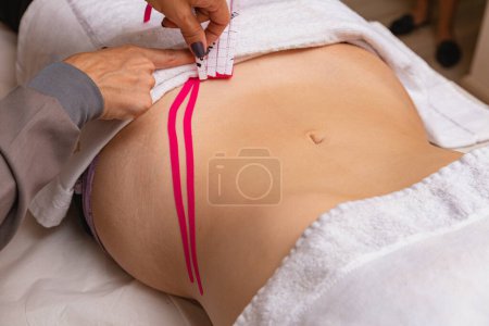 Photo for Therapeutic treatment with Kinesio Tapping - Royalty Free Image