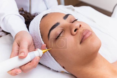 Foto de Mujer haciendo tratamiento facial con chorro de plasma en clínica de belleza. - Imagen libre de derechos