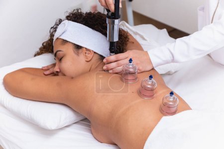 Foto de Mujer acostada en su pecho con tratamiento de ventosas en la espalda. mujer haciendo sucker - Imagen libre de derechos