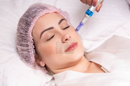 Photo for Beautiful woman receiving microneedling rejuvenation treatment. Mesotherapy. - Royalty Free Image