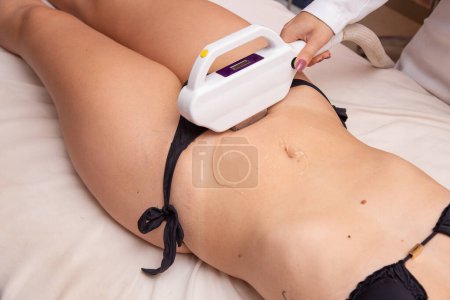 Photo for Woman removing groin hair with photoepilation. summer concept - Royalty Free Image