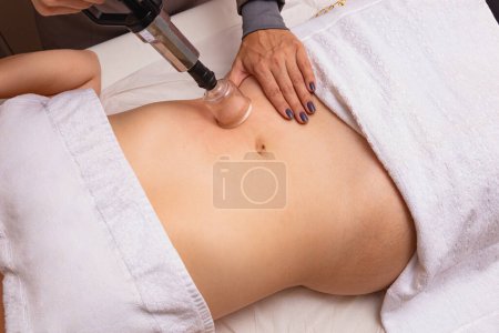 Foto de Mujer sometida a tratamiento con una ventosa en el vientre - Imagen libre de derechos