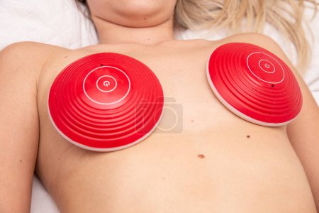 Téléchargez les photos : Femme subissant une procédure de levage de buste sur les seins pour réduire l'affaissement - en image libre de droit