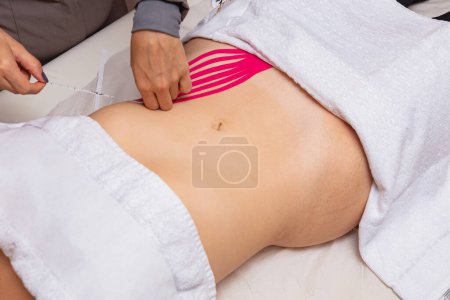 Photo for Therapeutic treatment with Kinesio Tapping - Royalty Free Image
