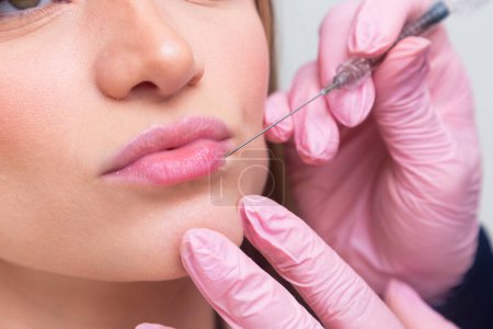 Woman wearing bathrobe in beauty clinic, aesthetics, patient, cosmetic procedures. application of hyaluronic acid. on the lips.