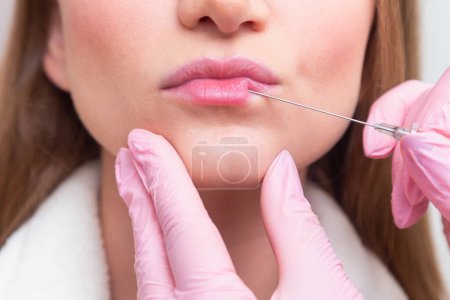 Photo for Woman wearing bathrobe in beauty clinic, aesthetics, patient, cosmetic procedures. application of hyaluronic acid. on the lips. - Royalty Free Image