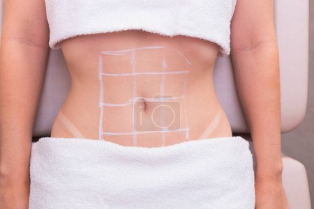 Photo for Close-up photo of a woman's belly, photo of aesthetics, procedures on the abdomen. beauty clinic. ozone application, ozone therapy, enzymes, slimming. weight loss. - Royalty Free Image
