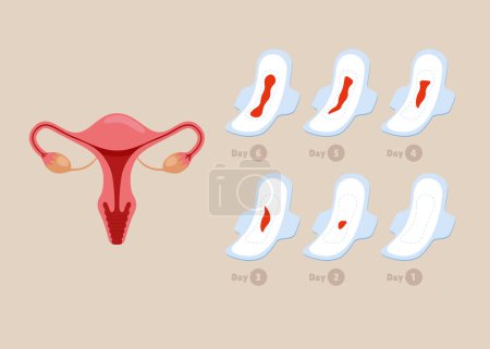 Serviettes hygiéniques féminines avec du sang. Période menstruelle saignante sur le tampon. Illustration vectorielle.