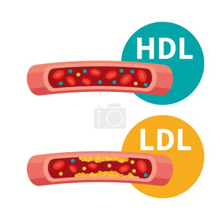 Illustration for Image illustration of cholesterol and blood vessels - Royalty Free Image