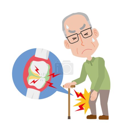 Illustration for Elderly man suffering from knee pain - Royalty Free Image