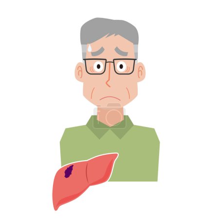 Middle-aged man with liver disease