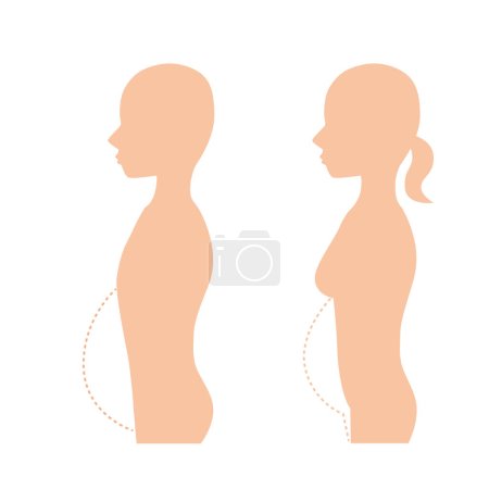 Illustration for Image illustration of a fat person losing weight - Royalty Free Image