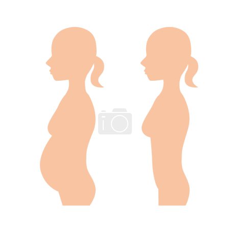 Illustration for Obesity before and after illustration - Royalty Free Image