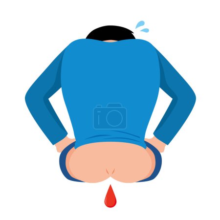 Illustration for A man suffering from hemorrhoids - Royalty Free Image