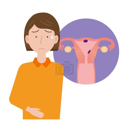 Illustration for Women worried about uterine cancer - Royalty Free Image