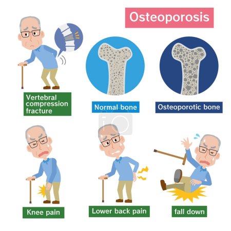 Téléchargez les illustrations : Image de l'ostéoporose et des hommes plus âgés - en licence libre de droit
