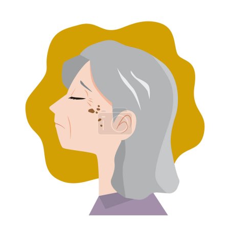 Téléchargez les illustrations : Illustration d'une femme âgée souffrant de taches cutanées - en licence libre de droit