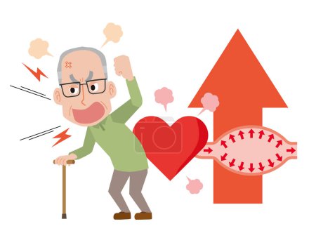 Ilustración de Un anciano cuya presión arterial aumenta debido a la ira - Imagen libre de derechos