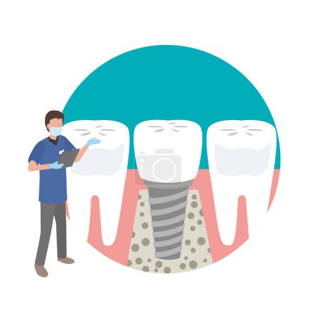 Illustration for Illustration of a dentist explaining dental implant treatment - Royalty Free Image