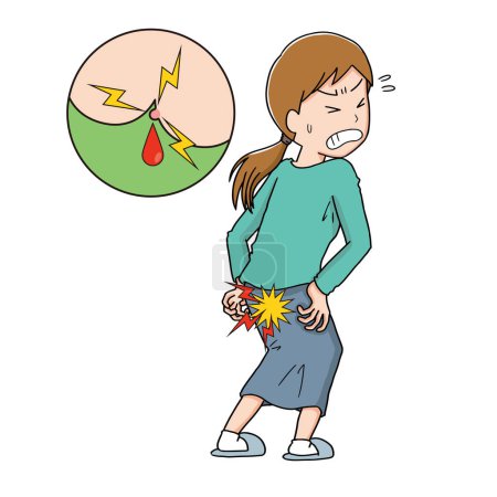 Illustration for A woman with painful hemorrhoids - Royalty Free Image