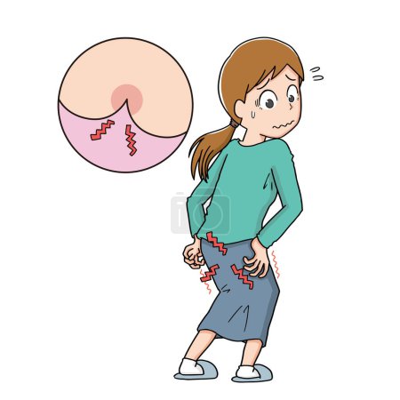 Illustration for A woman who is worried about discomfort in the buttocks - Royalty Free Image