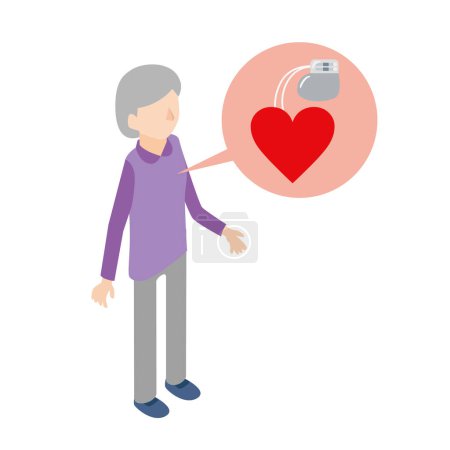 Illustration for An elderly woman with a pacemaker embedded - Royalty Free Image