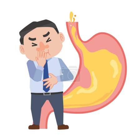 A man feels discomfort due to reflux esophagitis