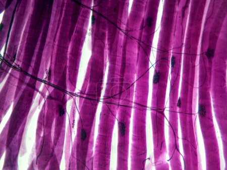 Photo for The Connection Between Nerves and Muscles: Motor Unit Synapse in High Detail - Royalty Free Image