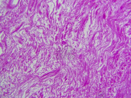 Photo for A Closer Look at the Dermis: Dense Irregular Connective Tissue in Detailed View - Royalty Free Image