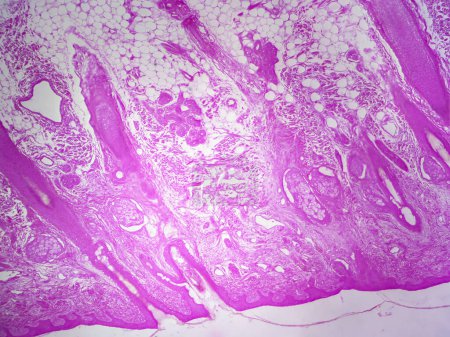 Téléchargez les photos : Follicule pileux et ses glandes : Vue détaillée sous le microscope - en image libre de droit