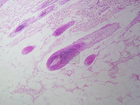 Photo for Zooming in on Hair Follicle and Its Glands: Stunning Detail in High Magnification - Royalty Free Image