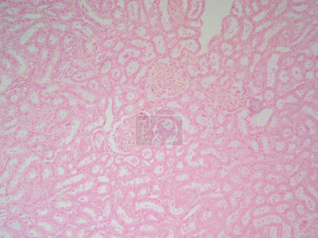 Foto de Primer plano de la anatomía renal: Corteza renal con túbulos y glomérulos a 100x - Imagen libre de derechos