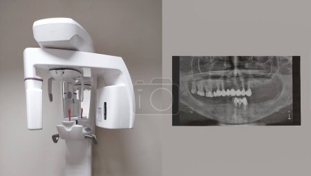 Téléchargez les photos : Tomographe numérique 3D dentaire moderne. Tomographe à cône dentaire, traitement et prévention de la cavité buccale - en image libre de droit
