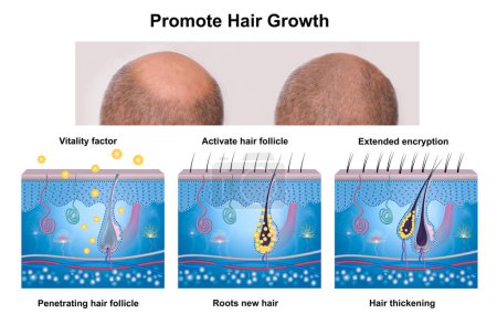 Fase de crecimiento del cabello, diagrama de anatomía del cabello humano. AD para aceite o suero para el crecimiento del cabello
