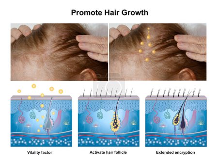 Fase de crecimiento del cabello, diagrama de anatomía del cabello humano. AD para aceite esencial o suero para el crecimiento del cabello