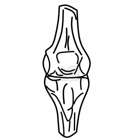 Illustration for Osteoarthritis linear icon. Cartilage inflammation. Degenerative joint disease. Pain in the knee. Customizable thin line illustration. Contour symbol. - Royalty Free Image