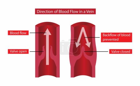 Ilustración de Ilustración de Biología y medicina, dirección del flujo sanguíneo en una vena, la válvula aórtica controla el flujo sanguíneo en la aorta y mantiene la sangre moviéndose en una dirección, la válvula aórtica es una de las cuatro válvulas cardíacas - Imagen libre de derechos