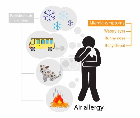 Téléchargez les illustrations : Illustration médicale et Pollution, Symptômes des allergies aéroportées, Particules dans les allergies à l'air, Les allergies sont causées par l'empoisonnement de l'air par les brûlures et les acariens - en licence libre de droit
