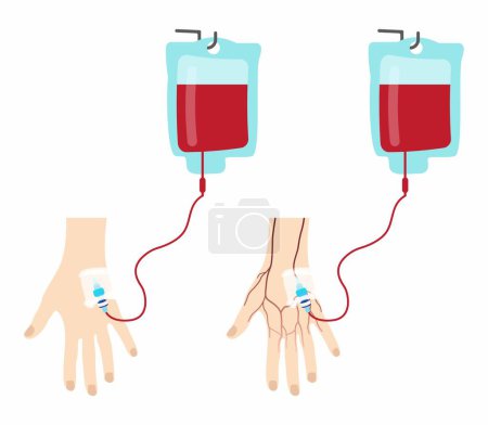 Illustration for Illustration of biology and medical, blood donation, Blood Transfusion and Intravenous Infusion, blood saline bag on drip safe patients life hope, recover, survive from sick, illness, emergency surge - Royalty Free Image
