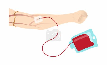 Illustration for Illustration of biology and Medical, Donate Blood, Platelets or Plasma, blood donations are truly life saving, A new sterile needle is inserted into a vein in arm - Royalty Free Image