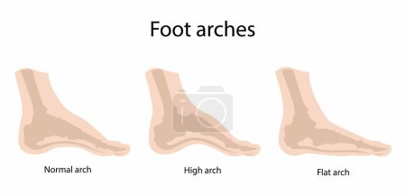 Illustration for Illustration of biology and medical, Foot arches, metatarsal bones, the ligaments and tendons in the foot, the foot to support the weight of the body - Royalty Free Image