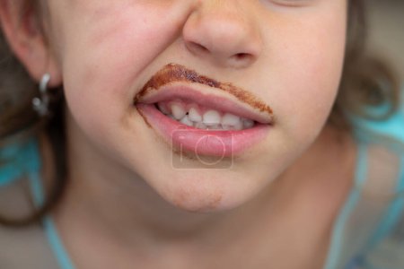 Mouth of a little girl grimacing and with a chocolate-stained mustache. Close-up photo. Sugary foods in children's nutrition.