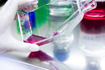 Scientists prepare samples of cancer cell culture solutions in the lab using a burette to pipette the solution for drug testing. Research and drug development, Medical, Pharmaceutical, Biochemistry.