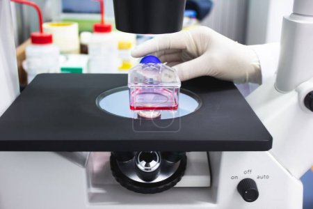 Les scientifiques utilisent un microscope pour examiner les cultures de cellules cancéreuses en laboratoire. Recherche et développement de médicaments, Médical, Pharmaceutique, Biochimie.